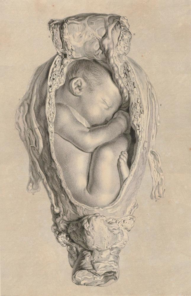 Anatomia uteri humani gravidi tabulis illustrata