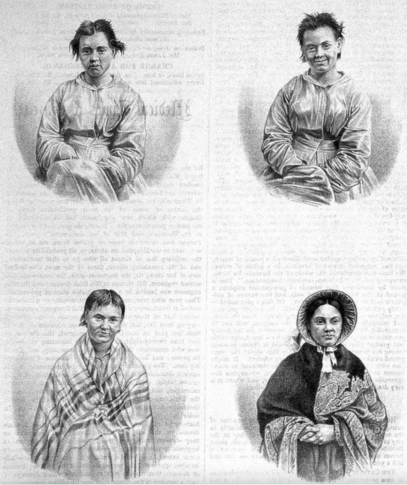 illustration of four stages of puerperal mania