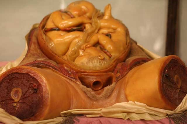 Obsterical model