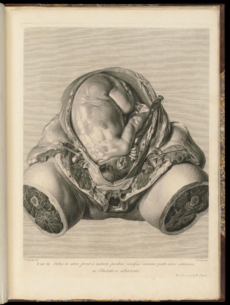 Fetus in utero
